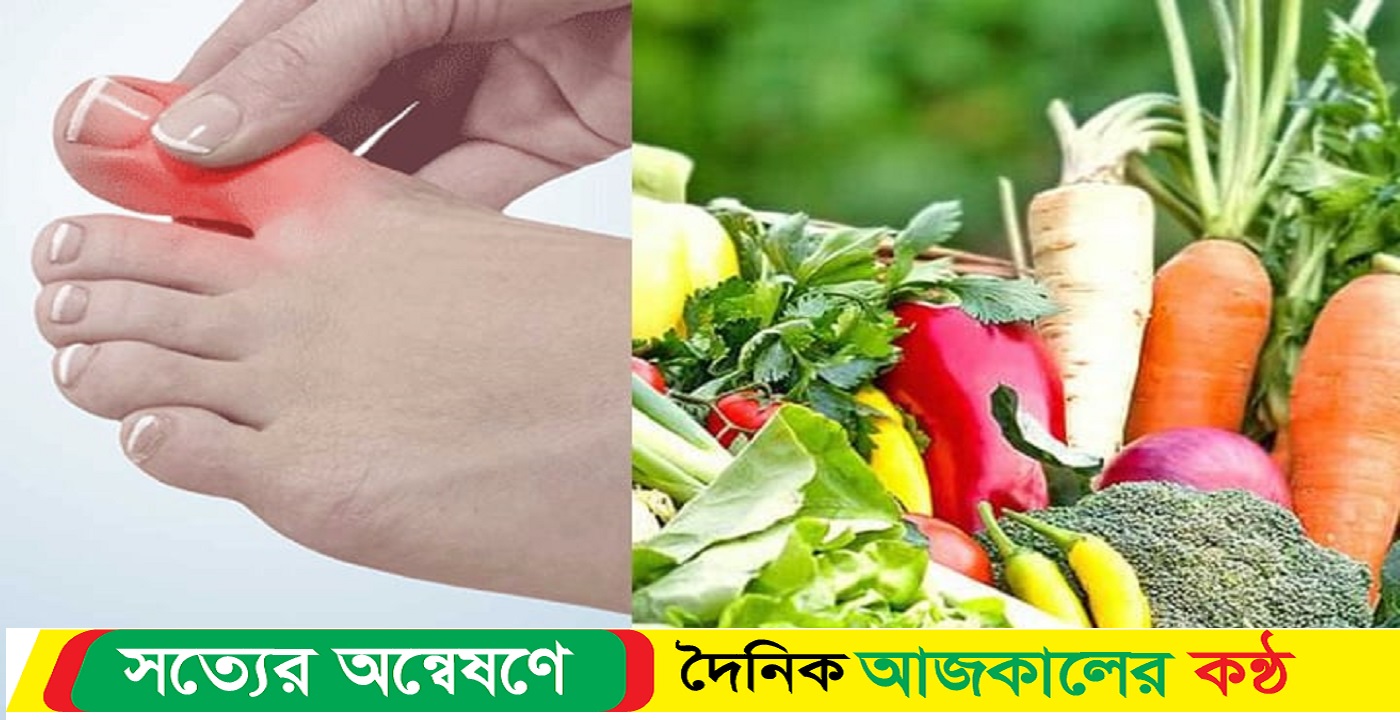 ইউরিক অ্যাসিড নিয়ন্ত্রণে উপকারী যেসব সবজি