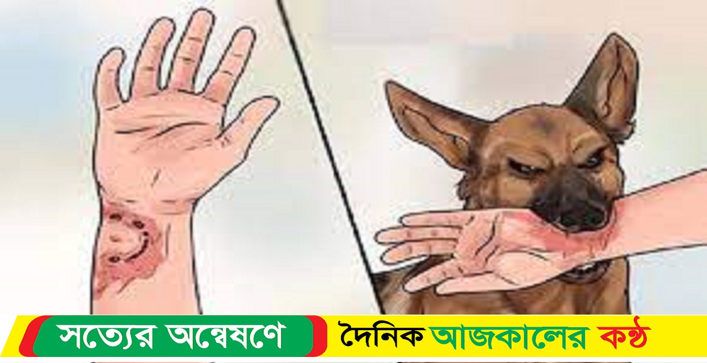 সুনামগঞ্জের জগন্নাথপুরে পাগলা কুকুরে কামড়ে আহত-৫ উপজেলা ব্যাপী শিয়াল-কুকুর ও বানর আতংক